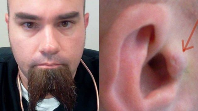 Un hombre se implanta los audífonos para no ponérselos y quitárselos todo el tiempo