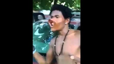El hombre 'boca de pato' invade Internet