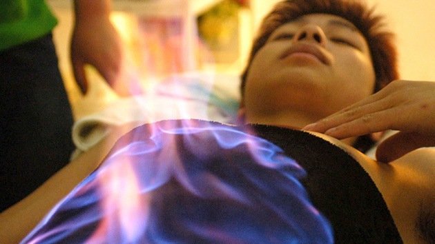 ¿Podría la alternativa 'terapia de fuego' china curar el cáncer?