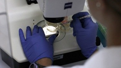 Hallazgo "histórico": Descubren nuevos genes que aumentan el riesgo de Alzheimer