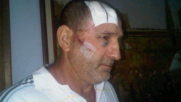 Enfrentamientos entre partidarios de Chávez y de Capriles dejan al menos 10 heridos
