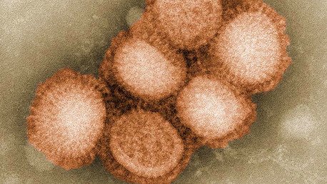 Las 'superbacterias' podrían matar a 10 millones de personas anualmente para 2050