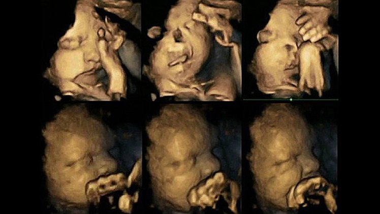 Imágenes impactantes: ¿qué experimenta el feto de la madre fumadora?