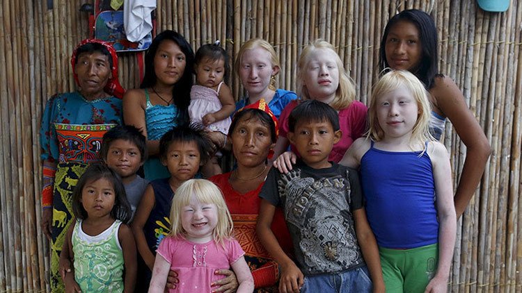 Hijos de la Luna: Cientos de niños albinos nacen en un pueblo indígena de Panamá