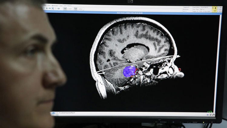 Científicos rusos crean un cerebro artificial, capaz de aprender por sí mismo