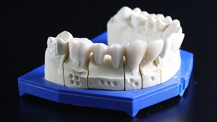 Los científicos revelan una causa inesperada que provoca dolor de dientes