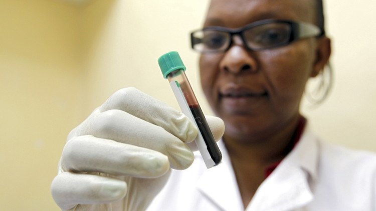 ¿Hallan en la sangre humana una 'llave' para vencer al VIH?