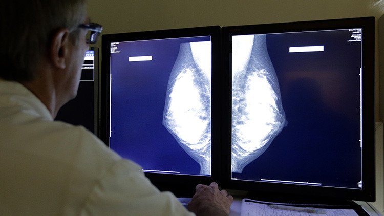 Hito en la ciencia genética: Hallan cinco nuevos genes vinculados con el cáncer de mama
