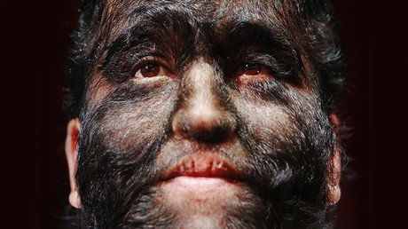 ¿Por qué existen los trastornos genéticos?: La ciencia resuelve la mayor paradoja evolutiva