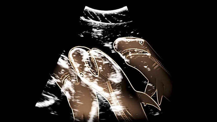 La impresionante ecografía de una hembra de tiburón embarazada