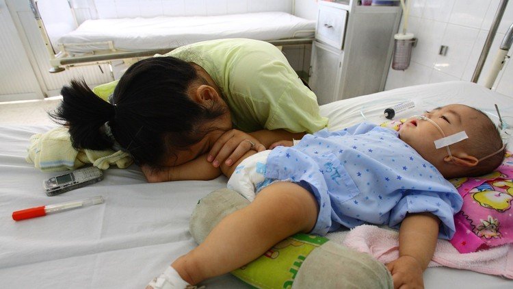 Morir durmiendo: los peligros de la 'maldición de Ondina'