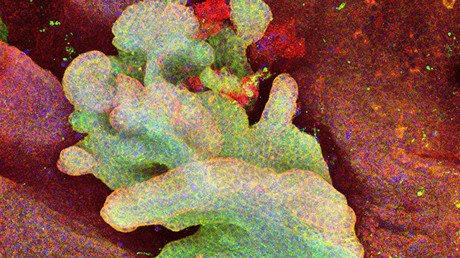 Los científicos observan por primera vez cómo nace el cáncer de piel