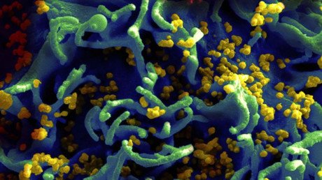 Los chimpancés transmiten el virus del sida a los humanos