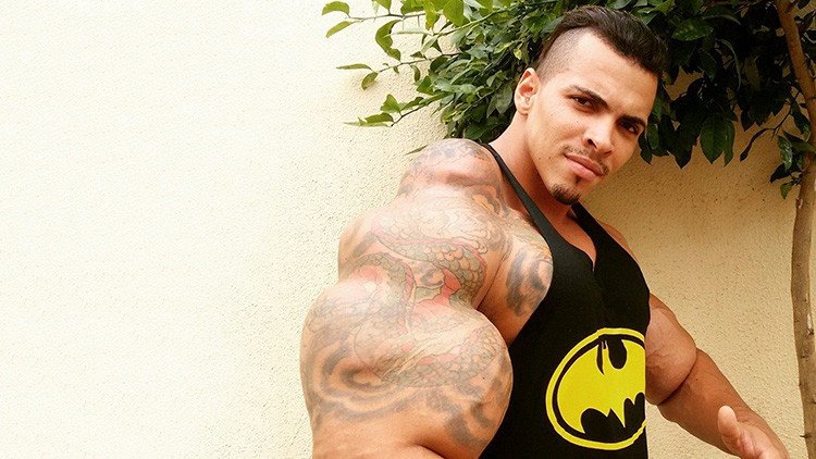 ¿Todo vale?: Así lucía el 'Hulk real' tras inyectarse una mezcla letal en sus brazos (FOTOS)