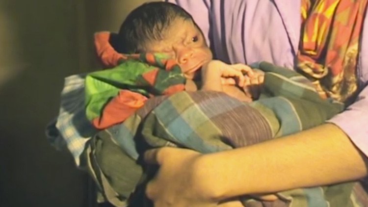 ADVERTENCIA, VIDEO FUERTE: Nace un bebé con el rostro de un anciano