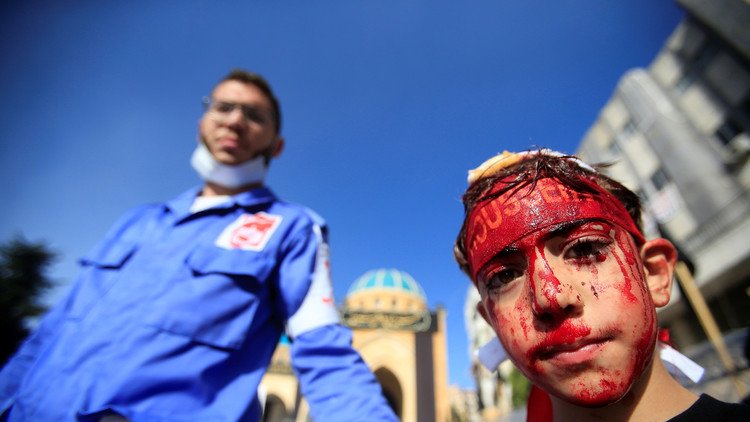 FUERTES IMÁGENES: Millones de devotos chiitas se bañan en sangre por fervor religioso