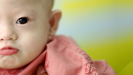 Una prueba médica podría erradicar el síndrome de Down