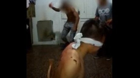 Joven argentino recibe una macabra bienvenida a una selección de hockey (FUERTES IMÁGENES)