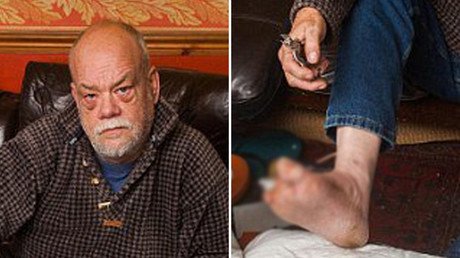 La increíble razón por la que un exsoldado se amputó dos dedos con unos alicates y sin anestesia