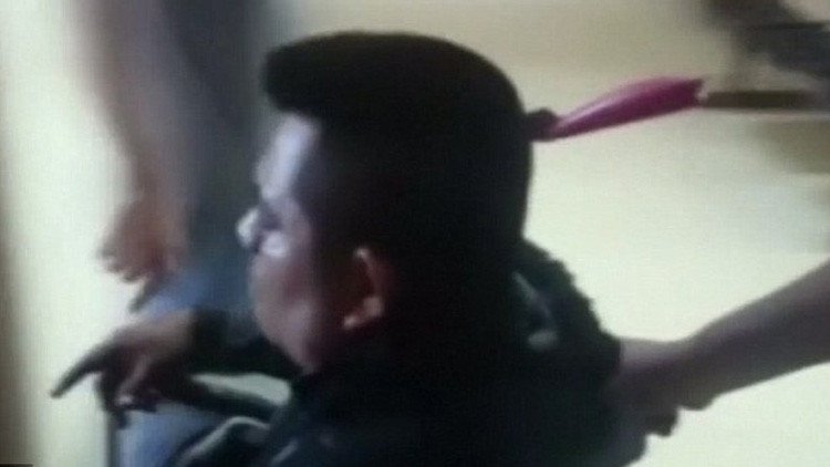 Perú: Un joven llega a un hospital con un cuchillo clavado en la cabeza (FUERTES IMÁGENES)