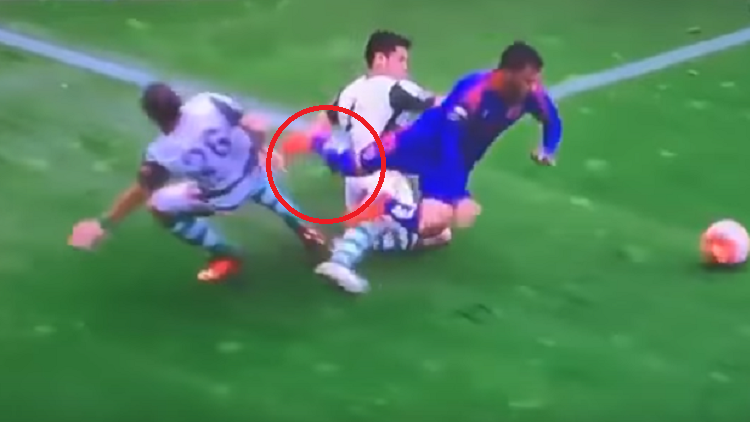 No apto para sensibles: Escalofriante fractura de tibia y peroné de un futbolista [video +18]