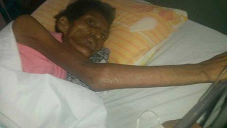 Muere la mujer que fue cruelmente maltratada por sus propios hijos en Bolivia