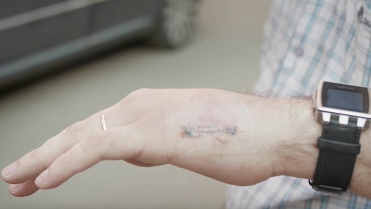 Video: Ingeniero ruso se implanta una tarjeta de transporte en su mano