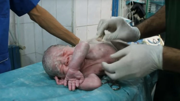 Impactante resucitación de un bebé en un hospital de Alepo (VIDEO CONMOVEDOR)