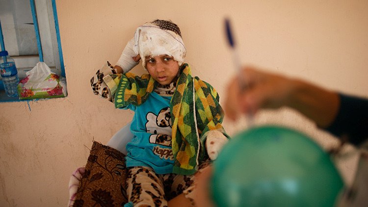 FUERTES IMÁGENES: Así sufren los horrores de la guerra los niños de Mosul
