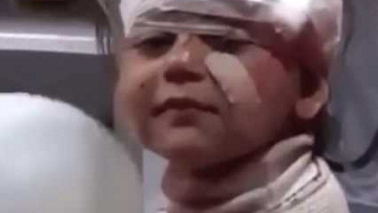 Desgarradoras imágenes: Niño herido sonríe a cámara tras atentado contra evacuados en Alepo  (Video)