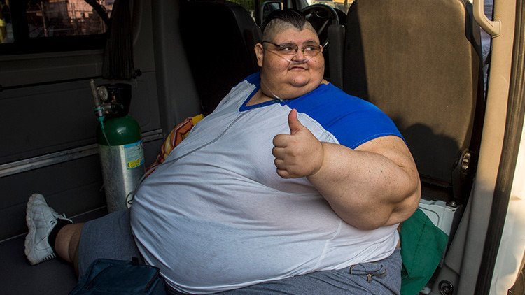 El hombre más obeso del mundo fue intervenido con éxito en México