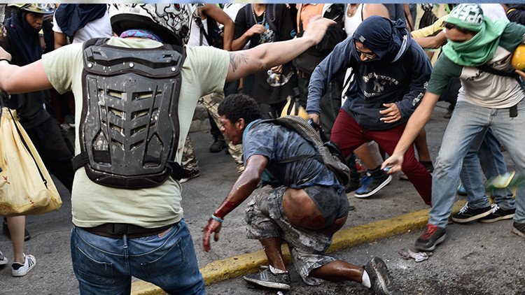 Muere Orlando Figuera, el joven quemado por opositores en Venezuela (FOTOS)