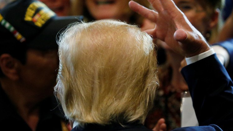 Lucir una tupida cabellera puede provocarle a Trump una "afección sin cura conocida"