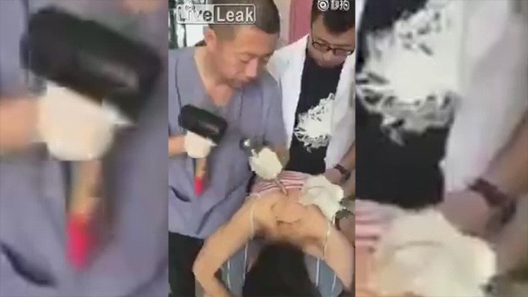 El brutal método chino para curar el dolor de espalda