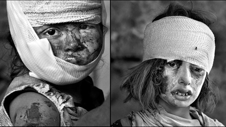 Las caras de la guerra: cicatrices en rostros y corazones de los habitantes de Mosul (18+)