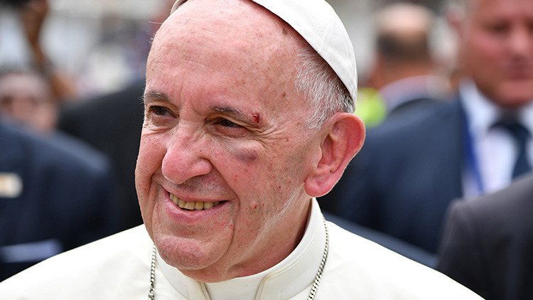 VIDEO, FOTOS: El papa Francisco se golpea el rostro en el papamóvil 