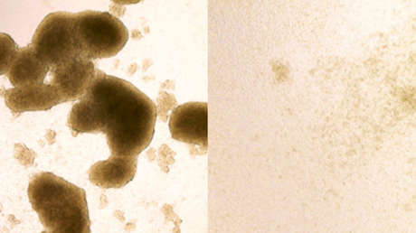 Hallan en un virus mortal una clave para curar tumores cerebrales