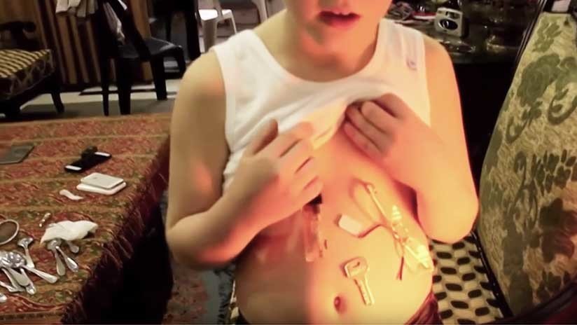 El 'niño magnético': Este menor atrae objetos de metal como si tuviera un imán en su barriga (VIDEO)