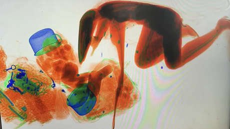 La insólita razón por la que una mujer 'se escanea' en una máquina de rayos X (VIDEO)