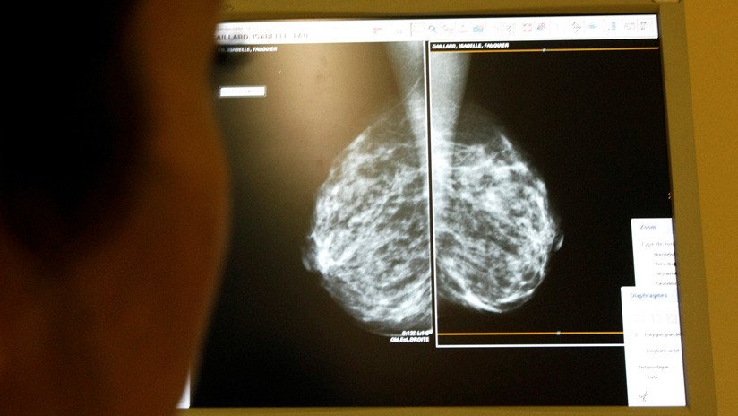 Error informático: 270 británicas habrían muerto de cáncer de mama y 450.000 no saben si lo sufren