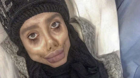 La 'Jolie zombi' iraní revela su cara real (FOTOS)