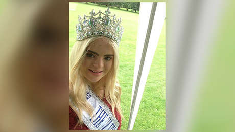 "Bondad y brillo interno": Joven con síndrome de Down gana un concurso internacional de belleza