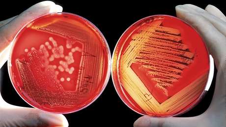 VIDEO: Un tratamiento cosmético viral puede contagiar con hepatitis o el VIH