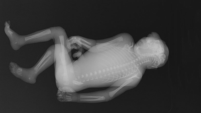 VIDEO: Controlaban equipajes con un escáner de rayos X y se les apareció un niño