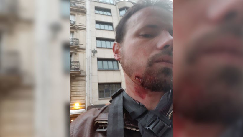 Dos periodistas de RT France resultan heridos durante la cobertura de las protestas en París