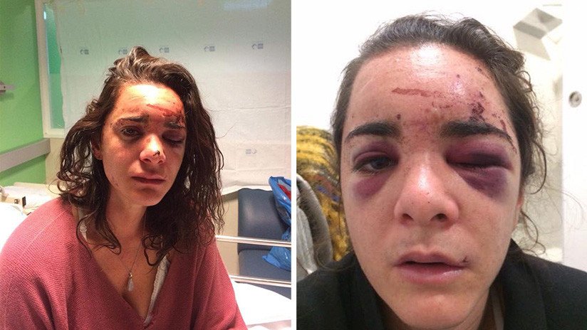 Una estadounidense denuncia una violación y brutal agresión en Madrid: "Pensé que me iba a matar"