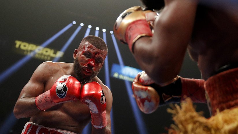 FOTO, VIDEO: Pierde una sangrienta pelea de boxeo tras sufrir un impactante corte en la frente