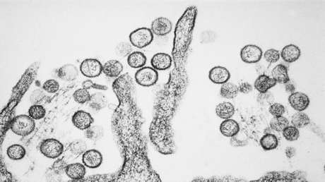Brote de hantavirus en Argentina: Confirman el primer caso en Jujuy