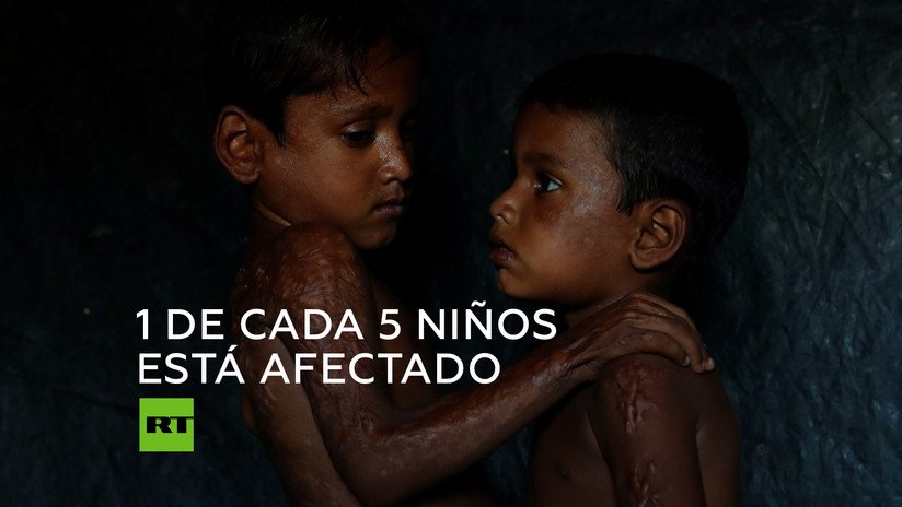 'Paren la guerra contra los niños', pide la ONG Save The Children