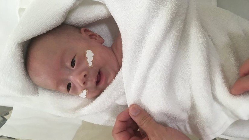 FOTOS: Sobrevive el bebé más pequeño del mundo (pesó 268 gramos al nacer)